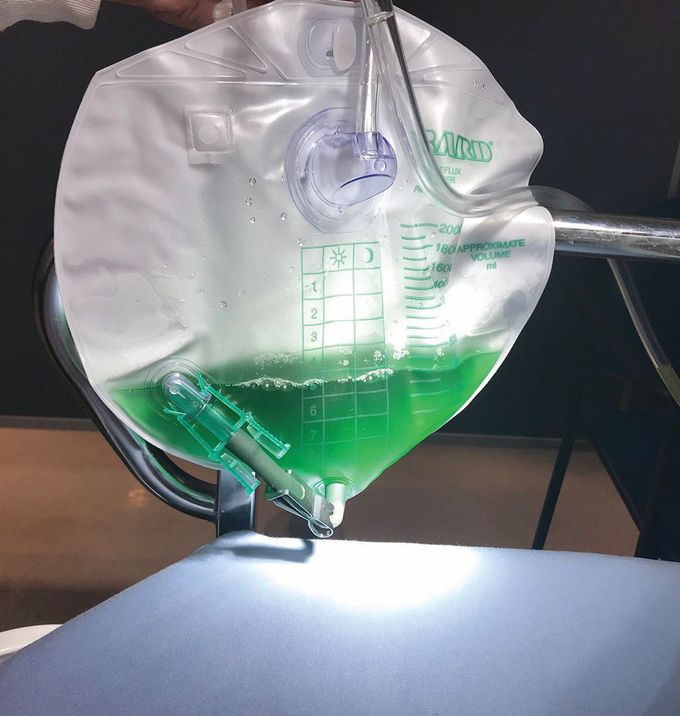 A Case of Green Urine