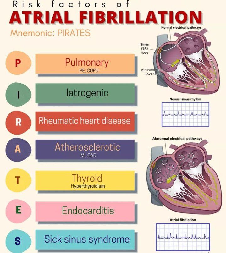 Risk factors of atrial fibrillation