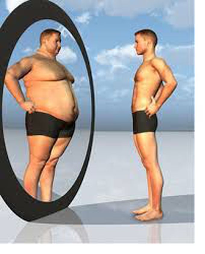 Anorexia Nervosa