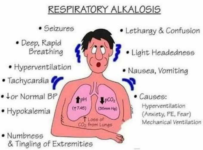 Respiratory Alkalosis