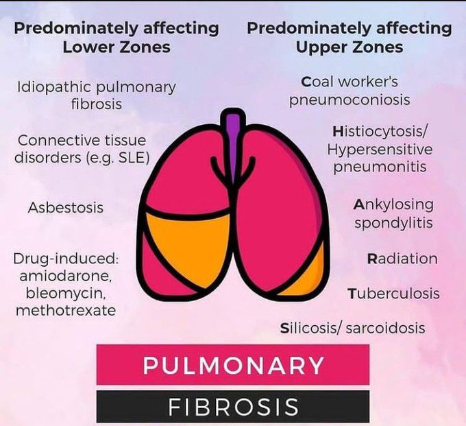 Pulmonary fibrosis