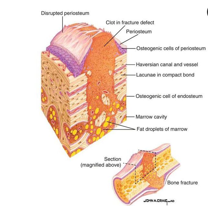 Fibroplastic stage of wound healing