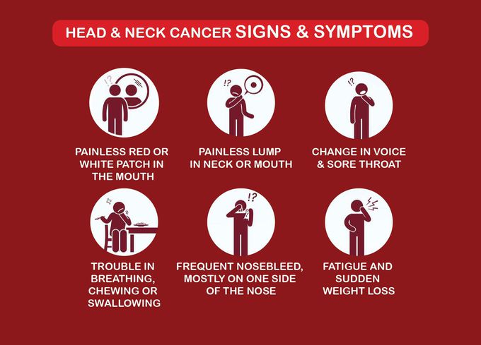 Symptoms of Head and neck cancer