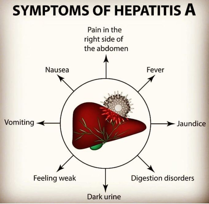 Hepatitis A - MEDizzy