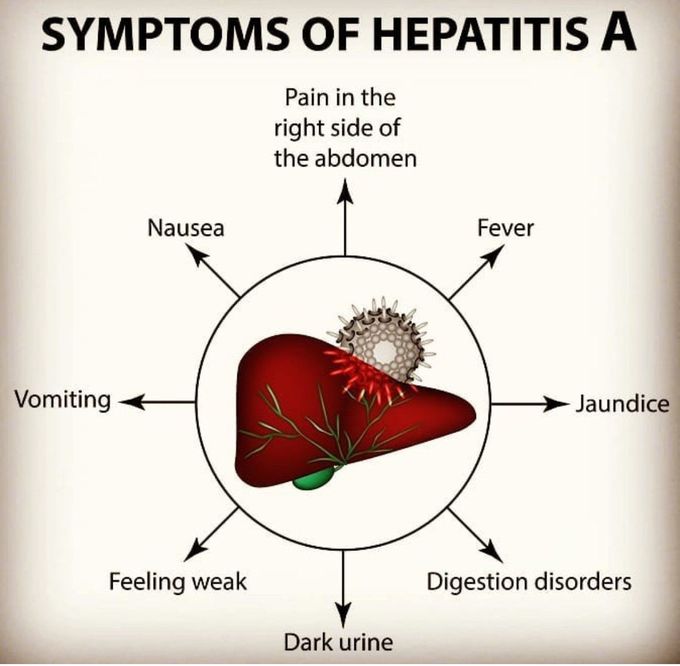 Hepatitis A