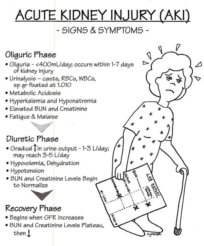 Acute Kidney Injury (AKI)