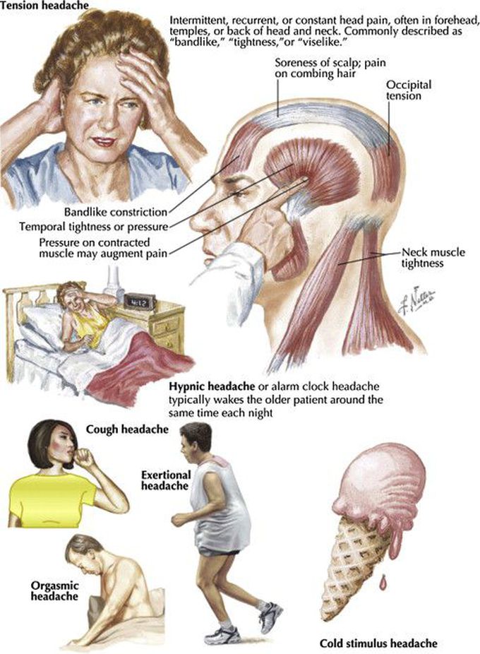 Hypnic headache