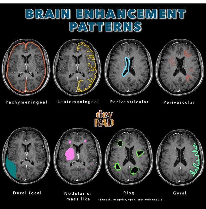 Brain Enhancement Pattern