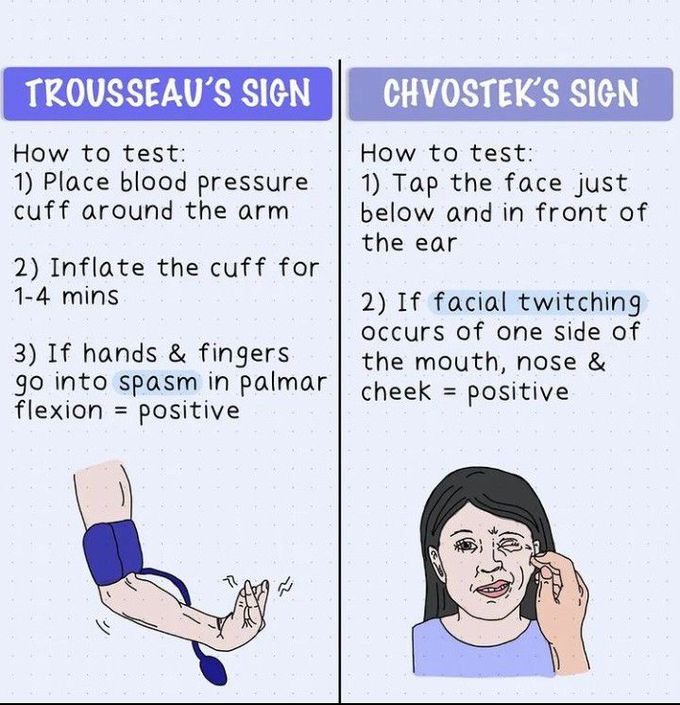 Trousseau's sign and chvostek sign