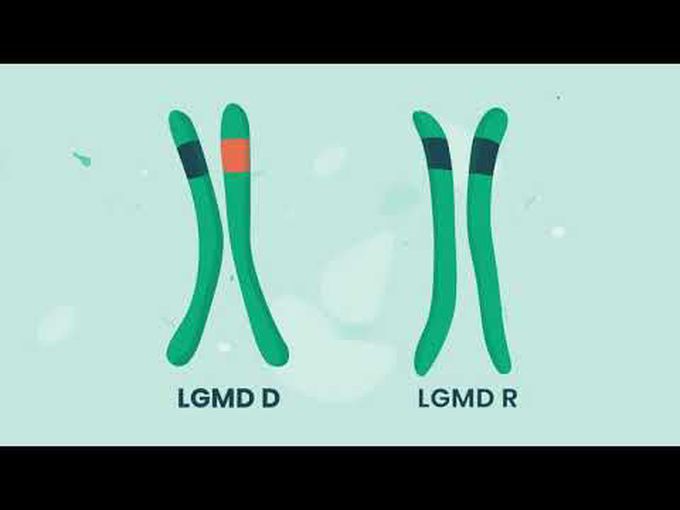 Pathology of Limb-girdle muscular dystrophy (LGMD)