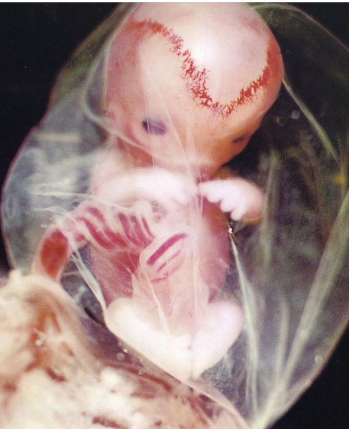 Human life before Birth....