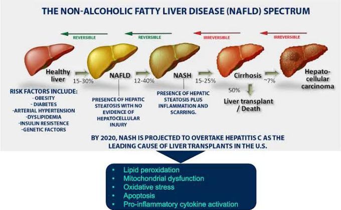 Non-alcoholic fatty liver disease