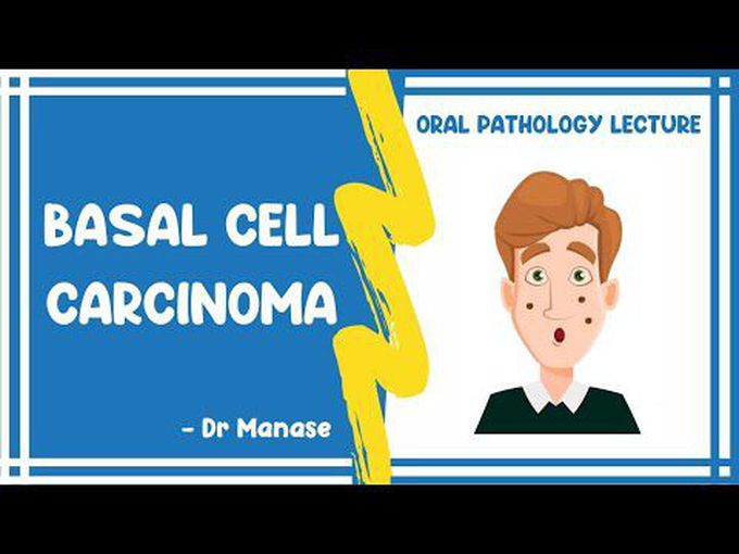 Introduction to BCC (basal cell carcinoma)