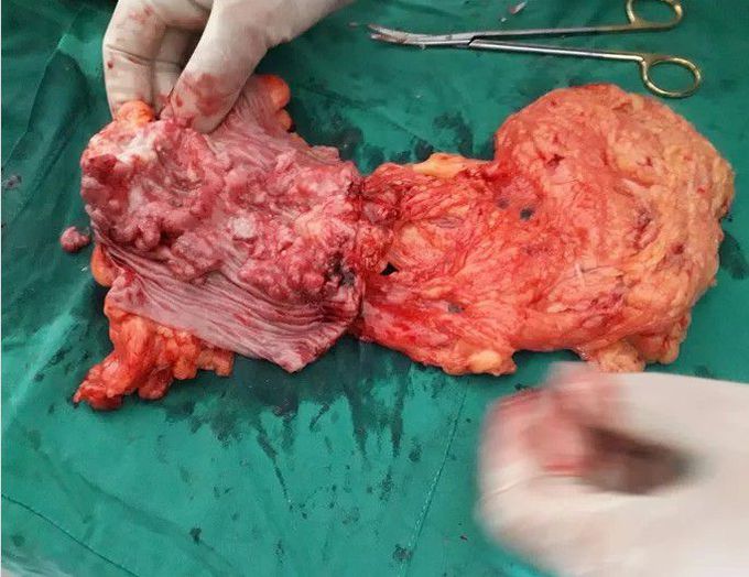 general surgery