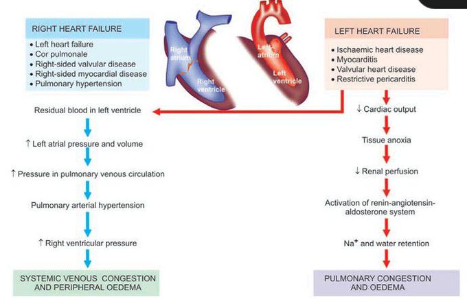 congestive heart failure