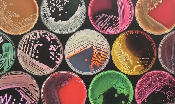 Gut microbiota may be the reason why cancer immunotherapy works for some but not all