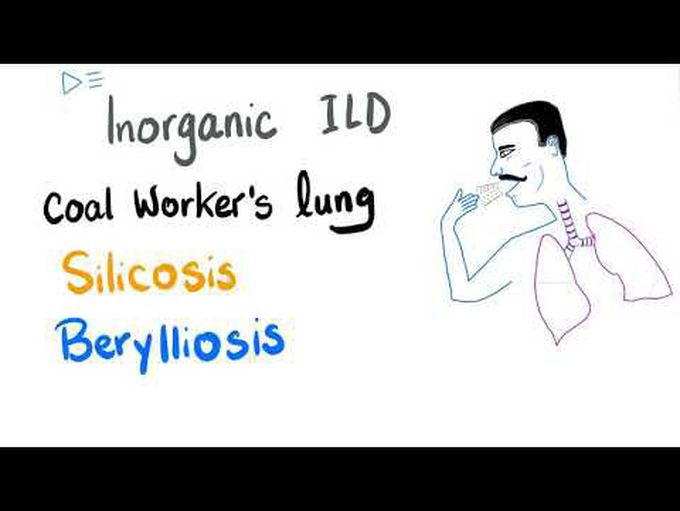 Pathology of Berylliosis, Silicosis, and Farmer’s lung