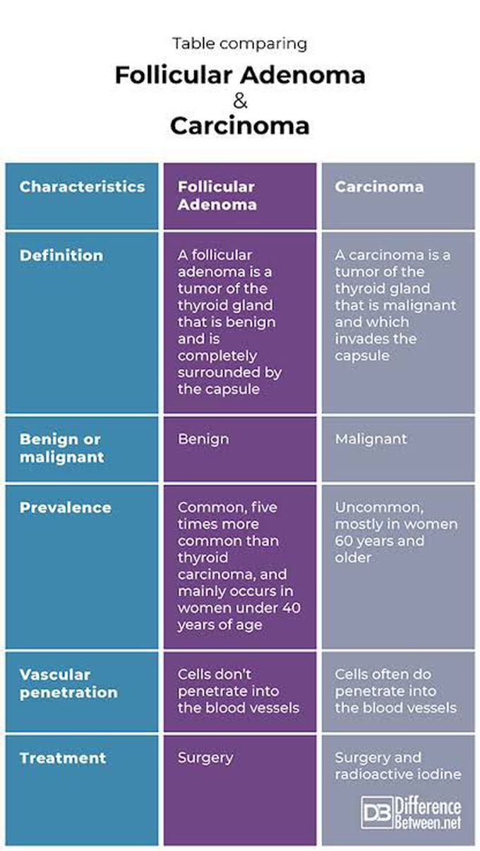 Follicular Adenoma Vs carcinoma