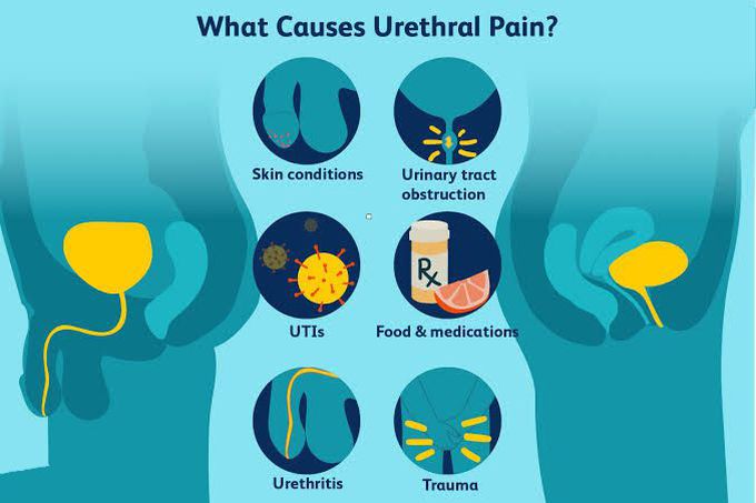 These are the causes of Urethral pain