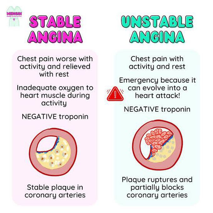Stable and Unstable Angina