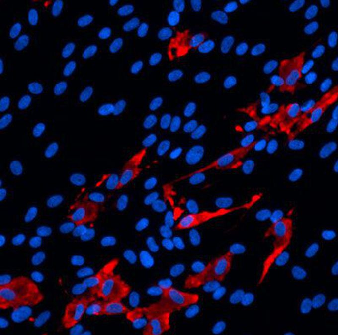 What scientists are learning about COVID-19 and the brain