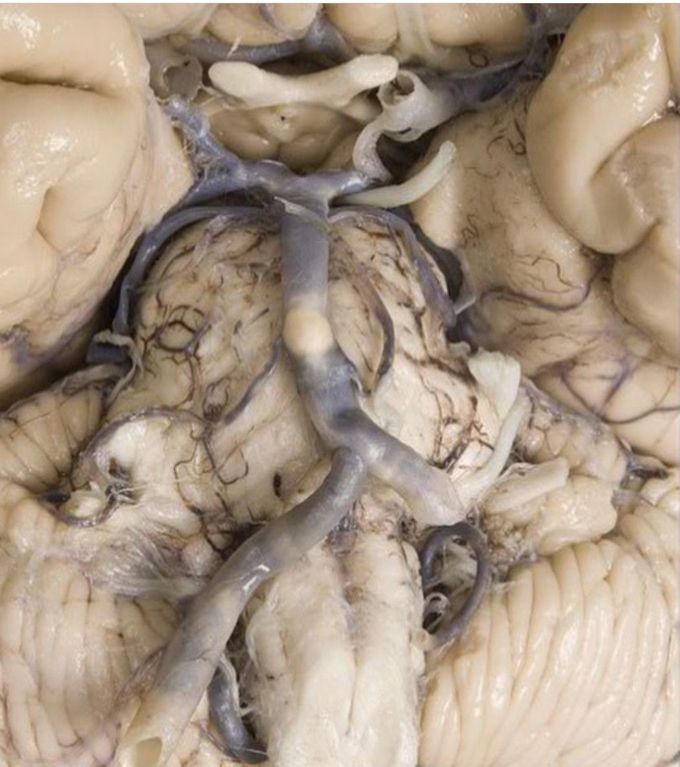 Ventral View of the Brain
