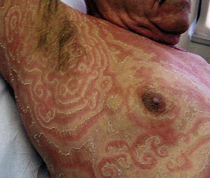 Diagnosis?