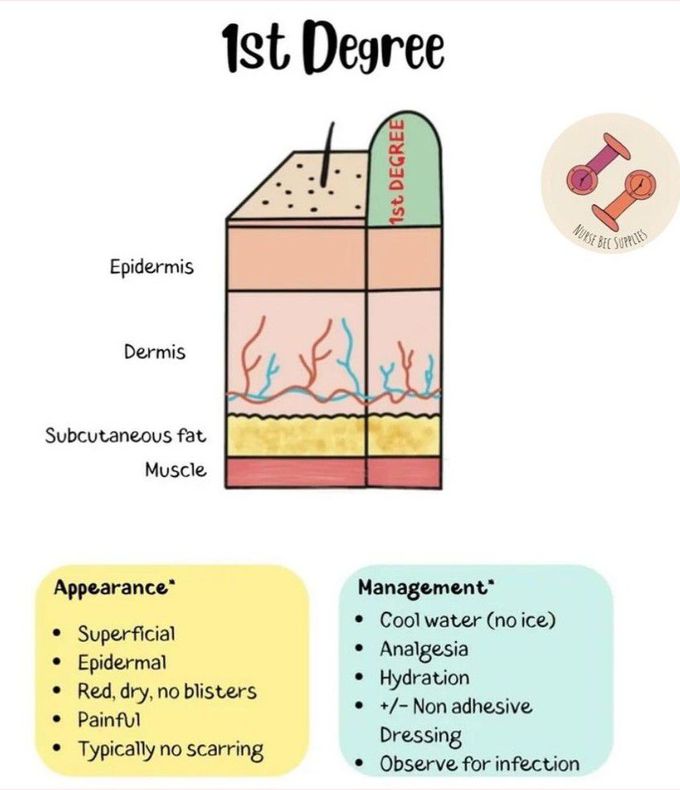 First Degree Burn