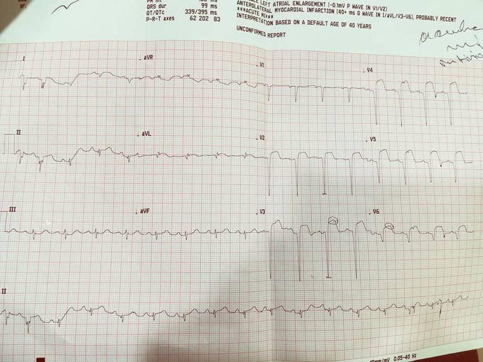 Ecg reports
