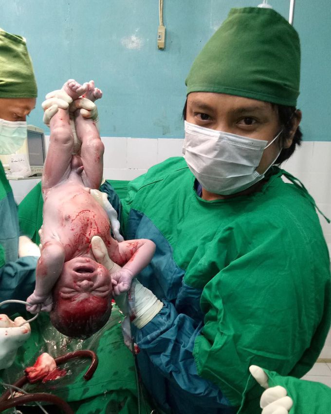 New baby boy delivered through emergency C-Section