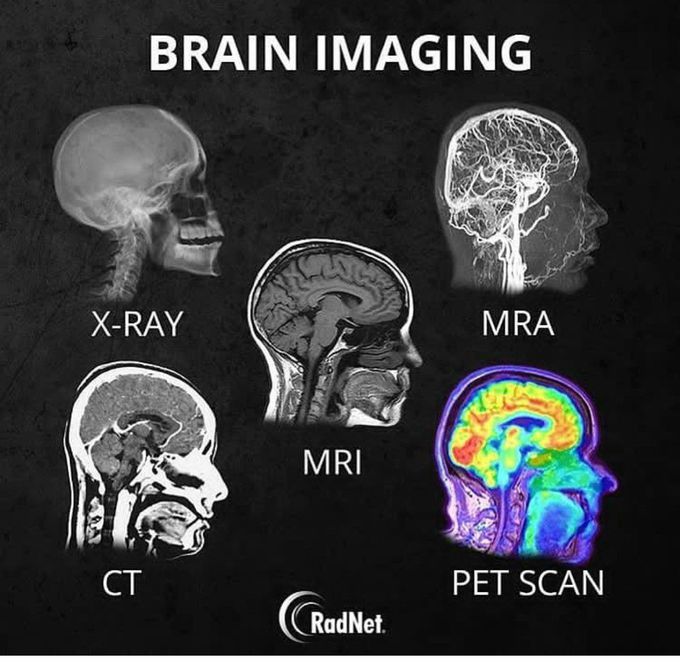Brain images