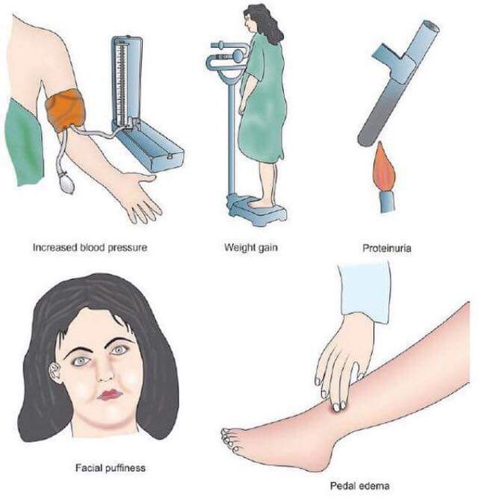 Diagnosis