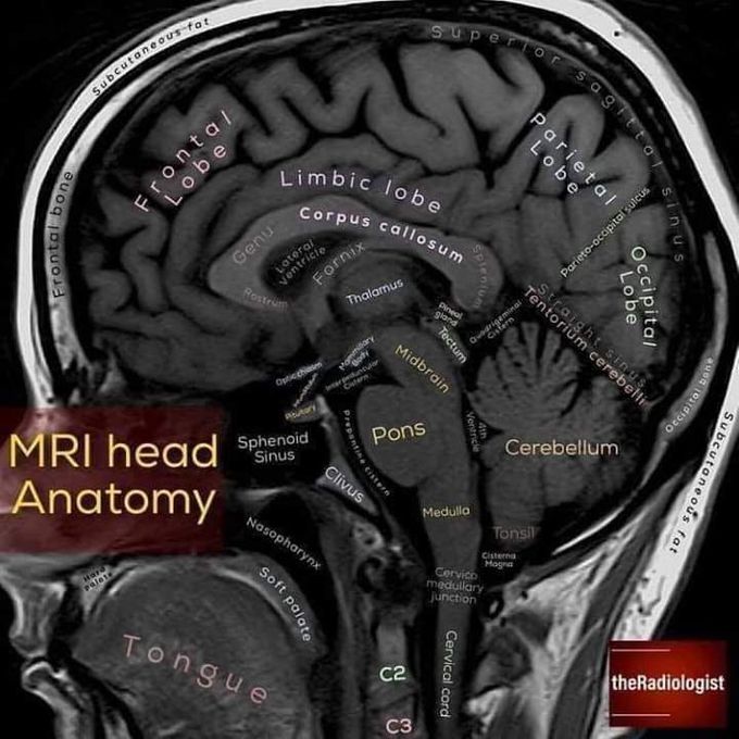 MRI Head Anatomy