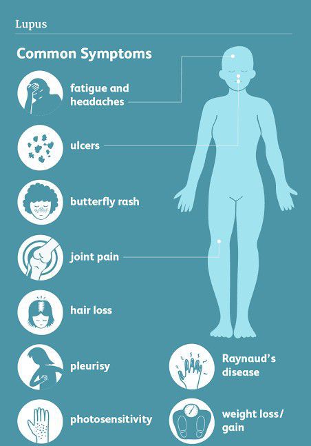 These are the symptoms of lupus - MEDizzy