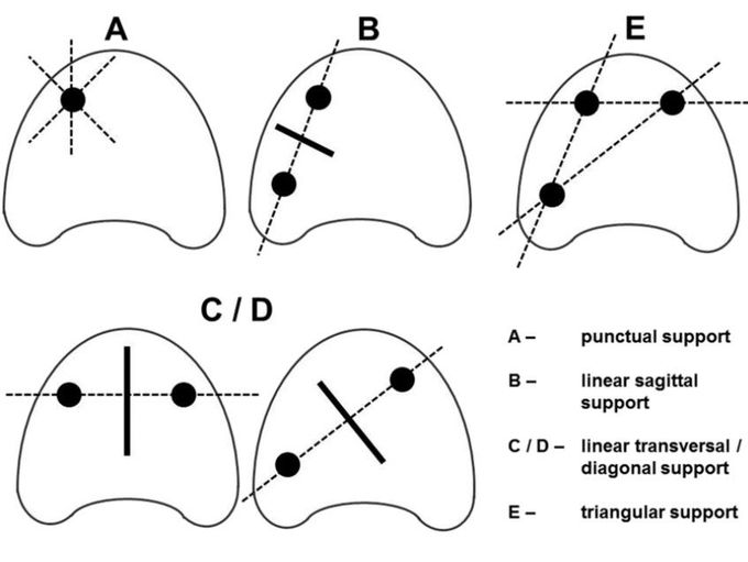 Steffle Classification