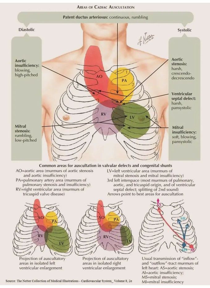 areas-of-cardiac-auscultation-medizzy