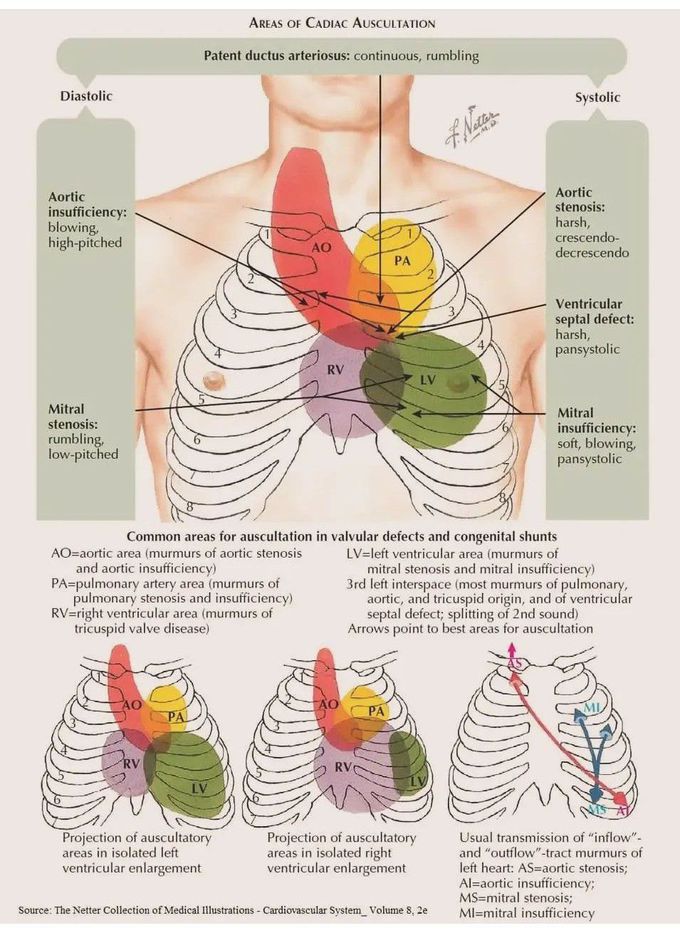 Areas of Cardiac Auscultation