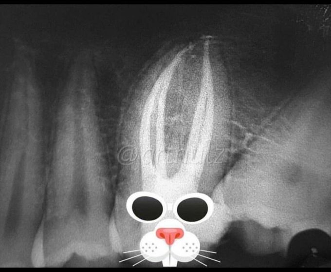 Teeth