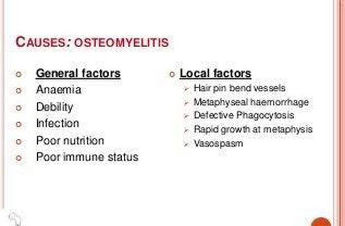 Causes of osteomyelitis