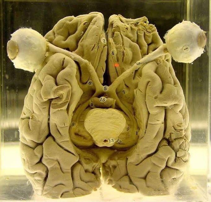 human brain with eyes