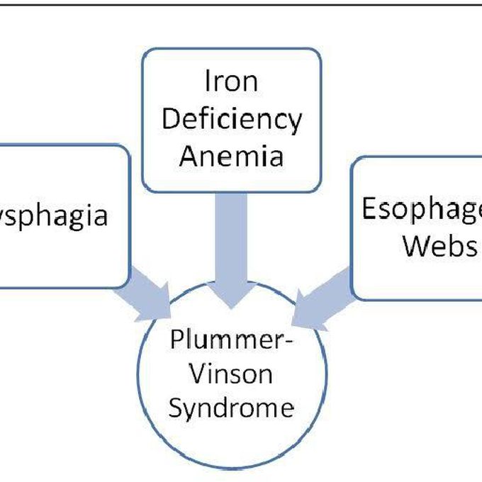 Plummer Vinson syndrome