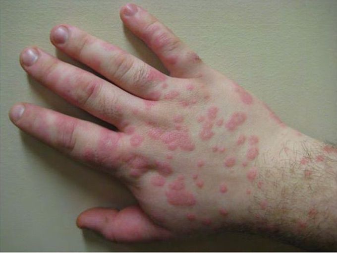 What is the diagnosis?