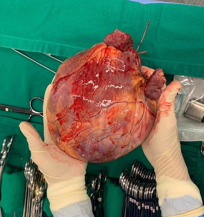 Heart