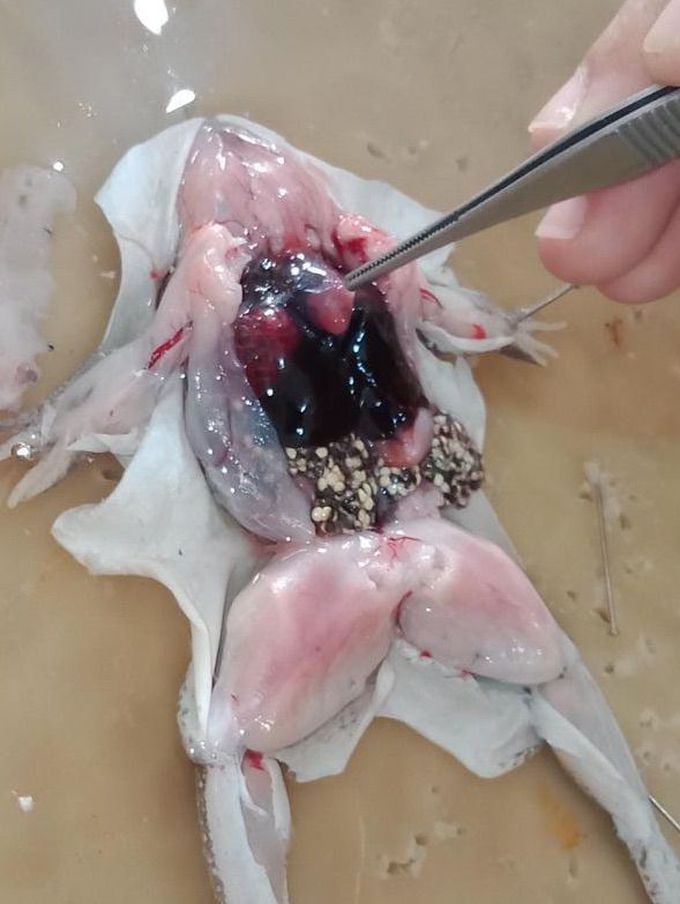 First disection “observing Anterior Veins”