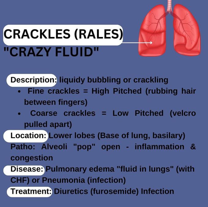 Crackles