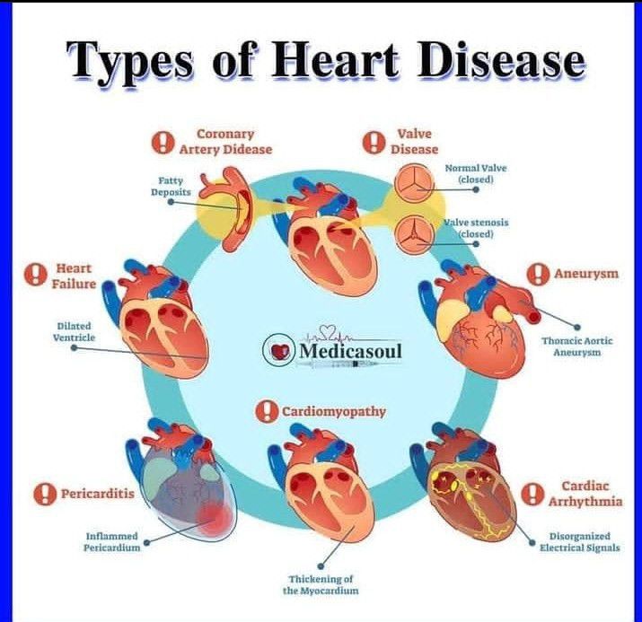 Types of heart diseases - MEDizzy