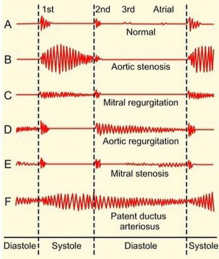 Cardiology Medizzy