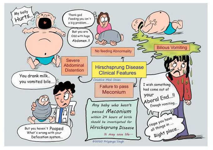 Hirschsprung Disease