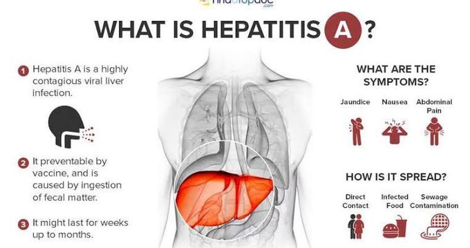 Symptoms of Hepatitis A