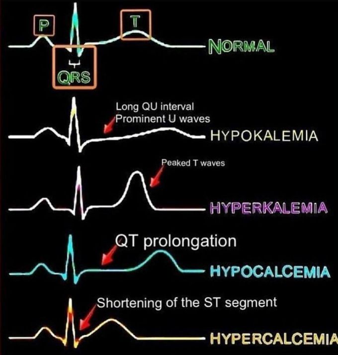 Learn ECG
